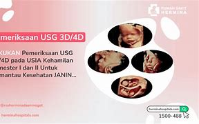 Arti Dari Usg 4D